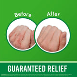Working Hands Hand Cream for Extreme Dryness - 3 Oz Tube (2 Pack) - Repairing Skincare for Cracked, Dry Hands